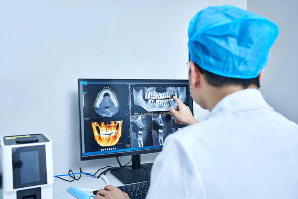 Best Emergency Dental Care for Broken or Chipped Teeth in Lodi, CA